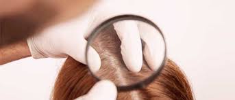 A importância da saúde do couro cabeludo para fios fortes e saudáveis